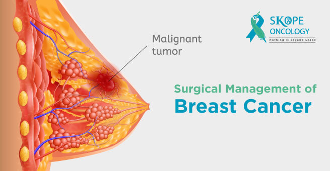 Surgical Management of Breast Cancer