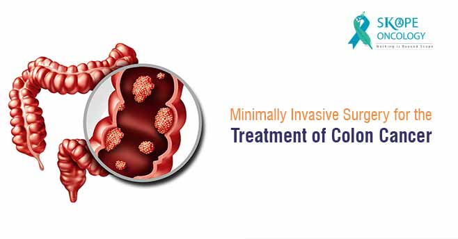 Minimally Invasive Surgery for the Treatment of Colon Cancer
