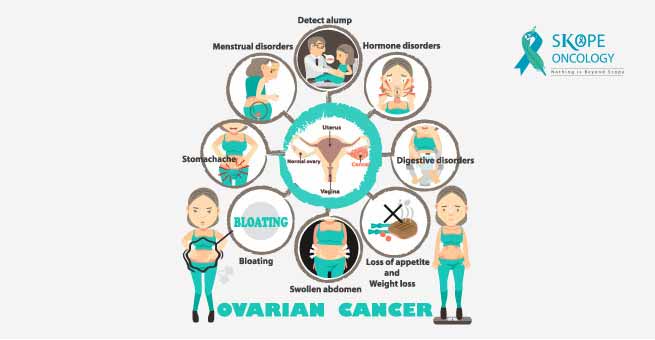common symptoms of ovarian cancer