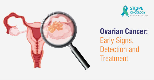 Ovarian Cancer : Early Signs, Detection and Treatment