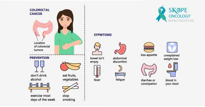 symptoms of colon cancer