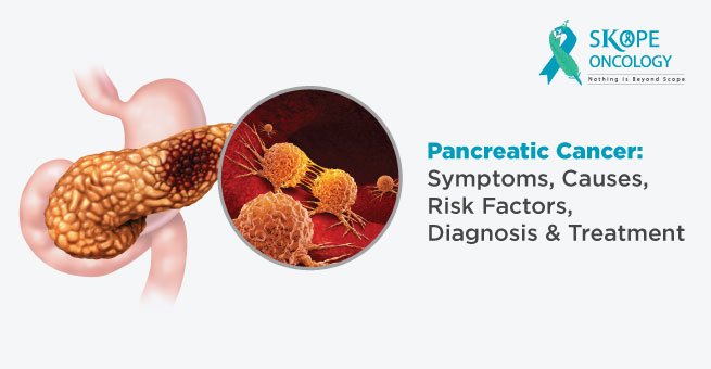 Pancreatic Cancer: Symptoms, Causes, Risk Factors, Diagnosis, Treatment