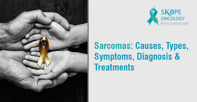Sarcomas: Causes, Types, Symptoms, Diagnosis & Treatment