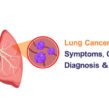 Lung Cancer: Symptoms, Causes, Diagnosis & Treatment