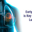 Early Detection is Key to Beating Lung Cancer