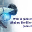 pancreatic-cancer-1