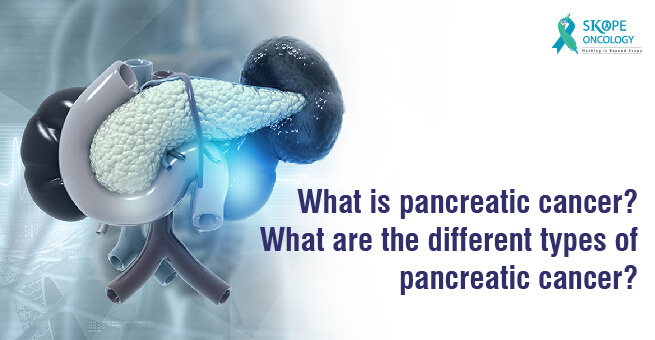 What is pancreatic cancer? What are the different types of pancreatic cancer?