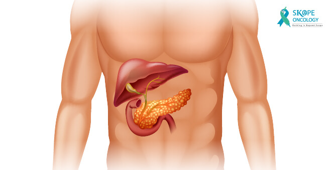 pancreatic-cancer-2
