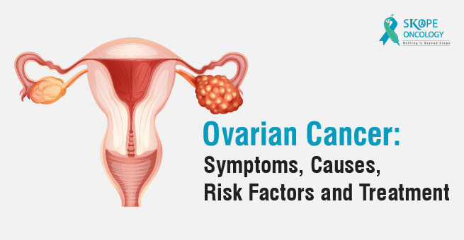 Ovarian Cancer: Symptoms, Causes, Risk Factors and Treatment