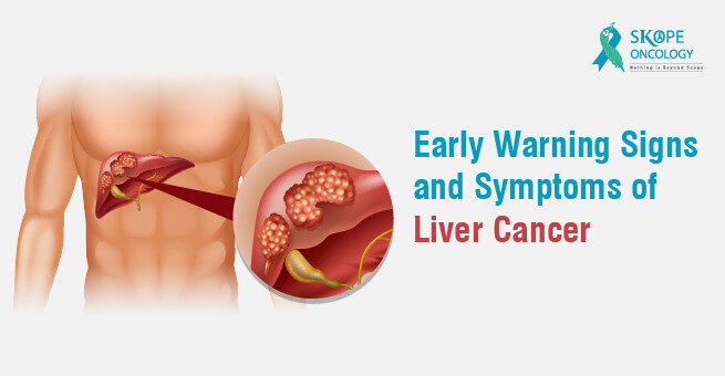 Early Warning Signs and Symptoms of Liver Cancer